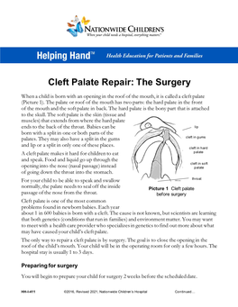 Cleft Palate Repair: the Surgery