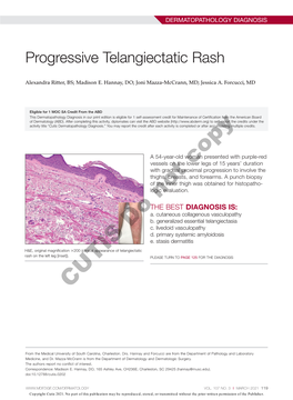 Progressive Telangiectatic Rash