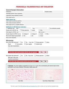 Francisella Tularensis Rule-Out Evaluation