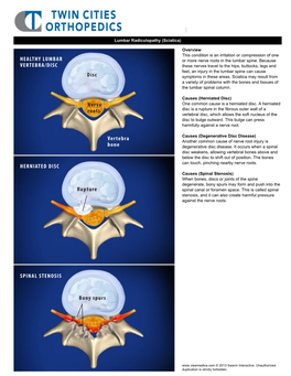 Lumbar Radiculopathy (Sciatica)