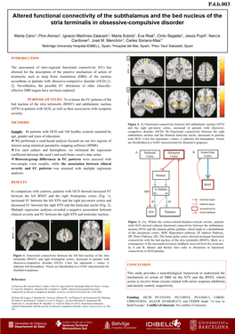 Altered Functional Connectivity of the Subthalamus and the Bed Nucleus of the Stria Terminalis in Obsessive-Compulsive Disorder