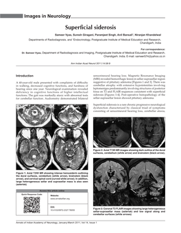 Superficial Siderosis