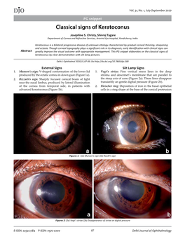 DJO Classical Signs of Keratoconus