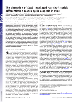 The Disruption of Sox21-Mediated Hair Shaft Cuticle Differentiation Causes Cyclic Alopecia in Mice