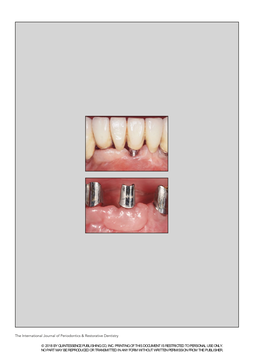 The International Journal of Periodontics & Restorative Dentistry