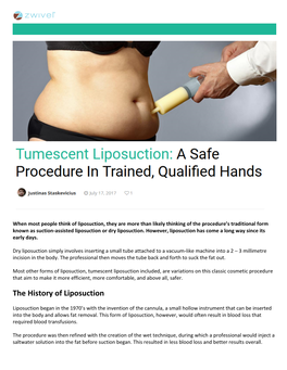 The History of Liposuction