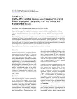 Case Report Highly Differentiated Squamous Cell Carcinoma Arising from a Suprapubic Cystostomy Tract in a Patient with Transplanted Kidney