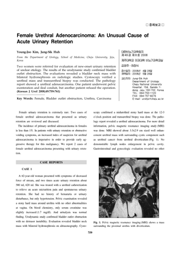 Female Urethral Adenocarcinoma: an Unusual Cause of Acute Urinary Retention