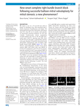 Onset Complete Right Bundle Branch Block Following Successful Balloon