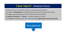 Eosinophilic Fasciitis Without Muscle Involvement Treatment