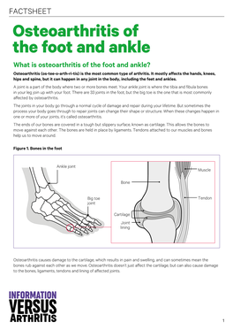 Osteoarthritis of the Foot and Ankle Factsheet