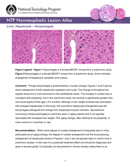 Liver, Hepatocyte – Karyomegaly