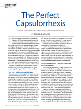 The Perfect Capsulorrhexis This Step in Cataract Surgery Dwarfs Many Other Steps in Importance