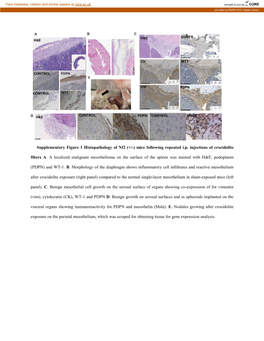 Supplementary Figure 1 Histopathology of Nf2 (+/-) Mice Following Repeated I.P