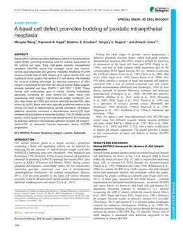 A Basal Cell Defect Promotes Budding of Prostatic Intraepithelial Neoplasia Mengdie Wang1, Raymond B