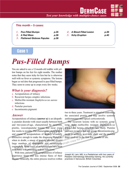 Pus-Filled Bumps P.35 4