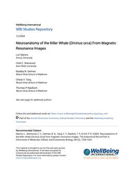 Neuroanatomy of the Killer Whale (Orcinus Orca) from Magnetic Resonance Images