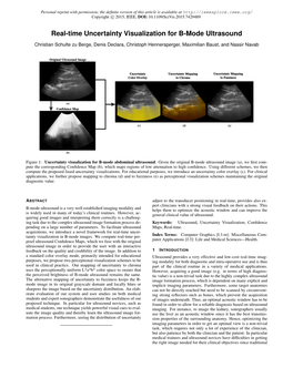 Real-Time Uncertainty Visualization for B-Mode Ultrasound