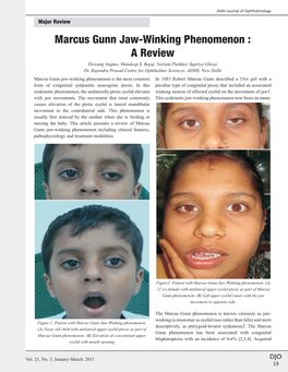 Marcus Gunn Jaw-Winking Phenomenon : a Review Dewang Angmo, Mandeep S