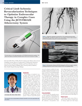 Dr Saab CLI Revascularization Techniques Case