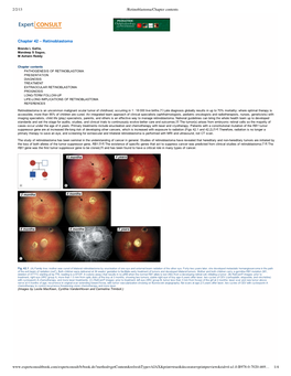 Retinoblastoma Tumor Collection