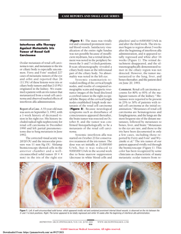 Sutureless Pars Plana Anterior Vitrectomy Through Self-Sealing