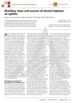 Maxillary Sinus and Success of Dental Implants: an Update