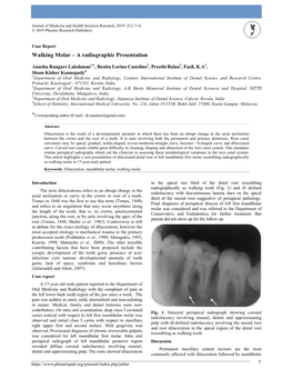 Walking Molar – a Radiographic Presentation