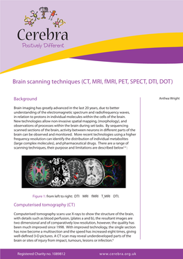 Brain Scanning Techniques (CT, MRI, Fmri, PET, SPECT, DTI, DOT)