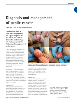 Diagnosis and Management of Penile Cancer