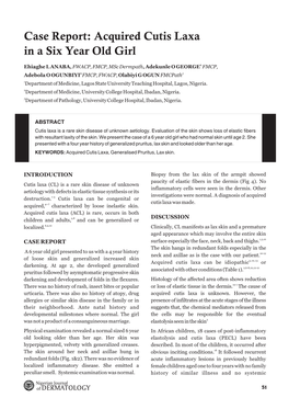 Case Report: Acquired Cutis Laxa in a Six Year Old Girl