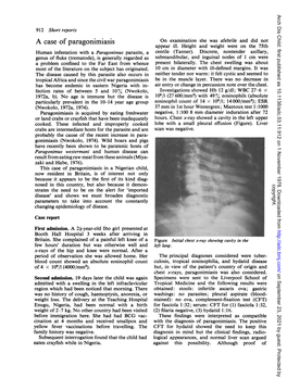 A Case of Paragonimiasis on Examination She Was Afebrile and Did Not Appear Ill