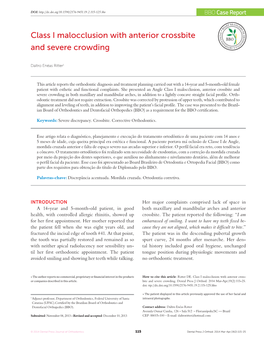 Class I Malocclusion with Anterior Crossbite and Severe Crowding