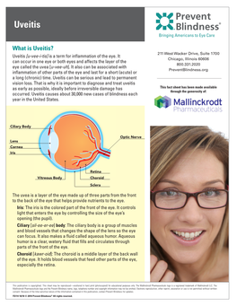 Anterior Uveitis • Intermediate Uveitis • Posterior Uveitis • Panuveitis Uveitis (Continued)