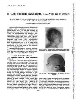 E (16-18) Trisomy Syndrome: Analysis of 13 Cases