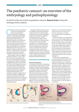 The Paediatric Cataract: an Overview of the Embryology and Pathophysiology