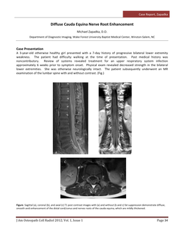 Diffuse Cauda Equina Nerve Root Enhancement