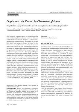 Onychomycosis Caused by Chaetomium Globosum