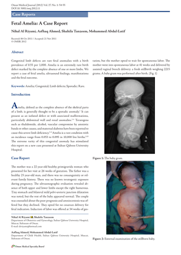 Fetal Amelia: a Case Report Nihal Al Riyami, Asfhaq Ahmed, Shahila Tanzeem, Mohammed Abdul-Latif