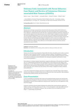 Osteoma Cutis Associated with Nevus Sebaceus: Case Report and Review of Cutaneous Osteoma- Associated Skin Tumors (Coasts)