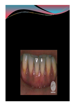 Pigmented Lesions of Oral Mucosa