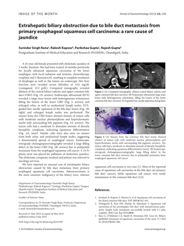 Extrahepatic Biliary Obstruction Due to Bile Duct Metastasis from Primary Esophageal Squamous Cell Carcinoma: a Rare Cause of Jaundice