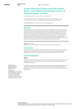 Ectopic Sebaceous Glands in the Hair Follicle Matrix: Case Reports and Literature Review of This Embryogenic Anomaly