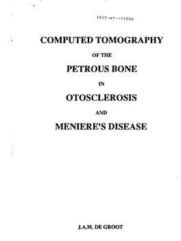 Computed Tomography Petrous Bone Otosclerosis