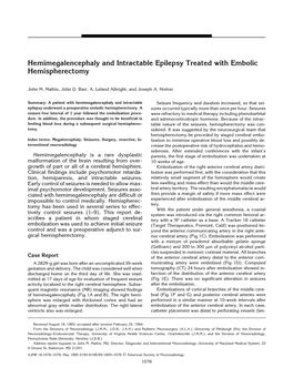 Hemimegalencephaly and Intractable Epilepsy Treated with Embolic Hemispherectomy