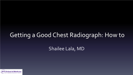 Getting a Good Chest Radiograph: How To