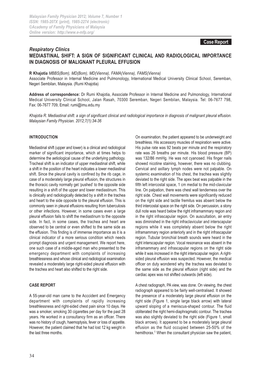 Mediastinal Shift: a Sign of Significant Clinical and Radiological Importance in Diagnosis of Malignant Pleural Effusion