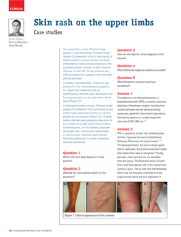 Skin Rash on the Upper Limbs