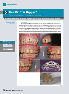 How Did This Happen? Townies Discuss Sleep Bruxism and How to Prevent Occlusal Wear