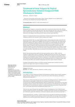 Treatment of Acne Vulgaris by Topical Spironolactone Solution Compared with Clindamycin Solution